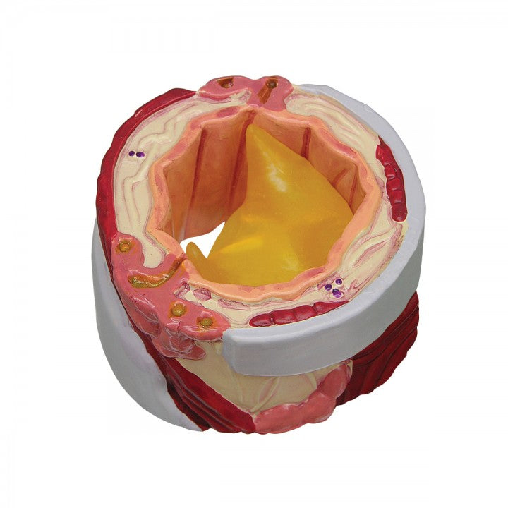 Bronchus Model 3120 slice