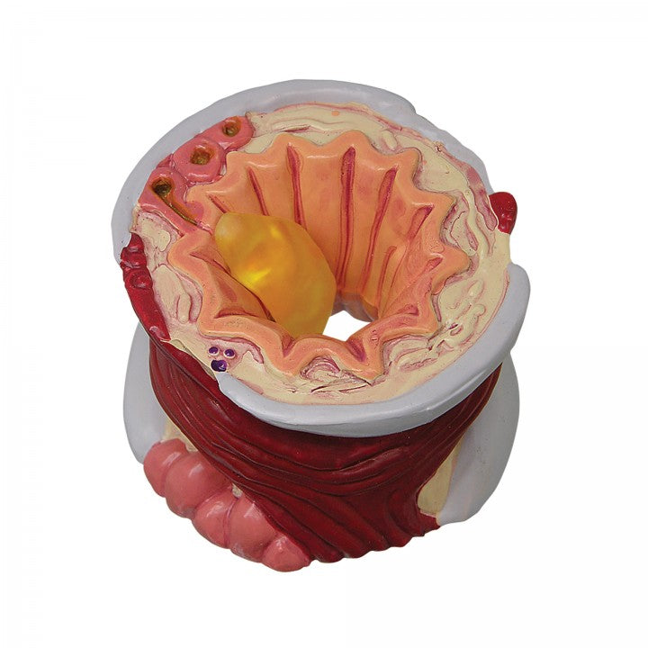 Bronchus Model 3120 slice