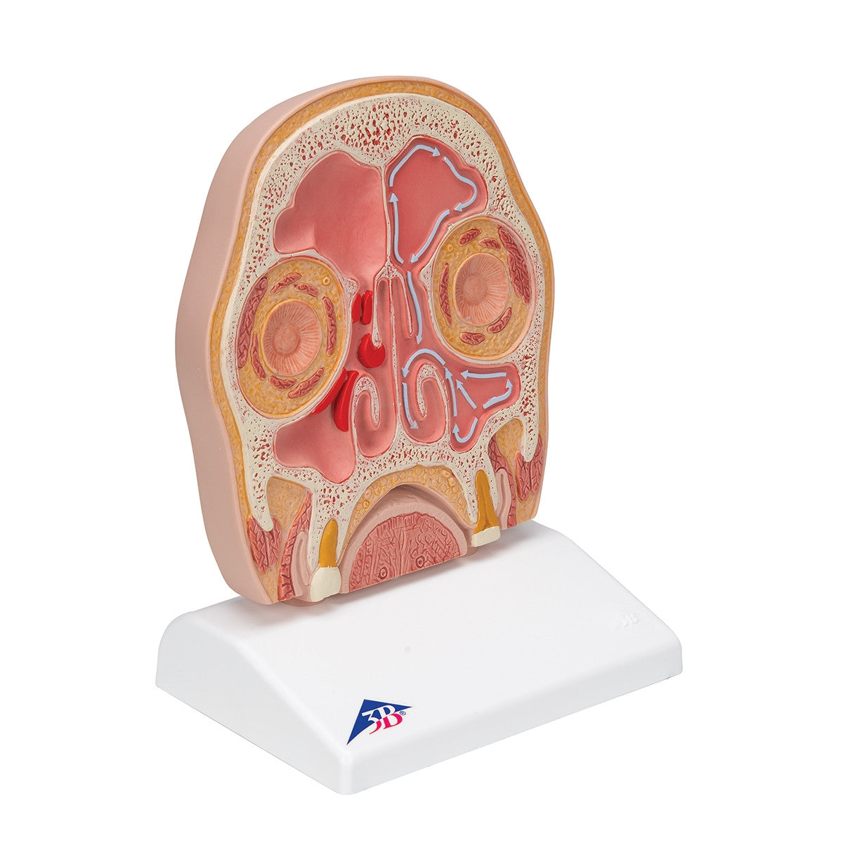 Head Section Model with Sinusitis