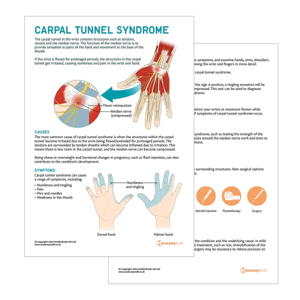 Carpal Tunnel Syndrome Patient Education Handout