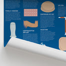 Switch Contraception: Do you know your options? Chart / Poster 2 image