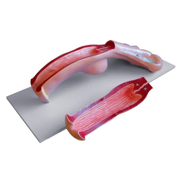 Cow Uterus Model (2 Part)