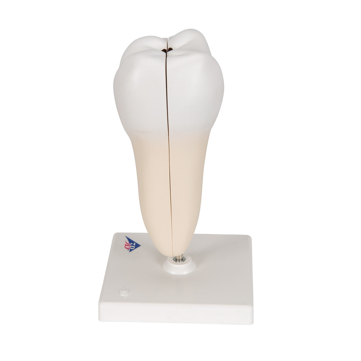 Lower Twin-Root Molar Model showing Cavities (2 part)