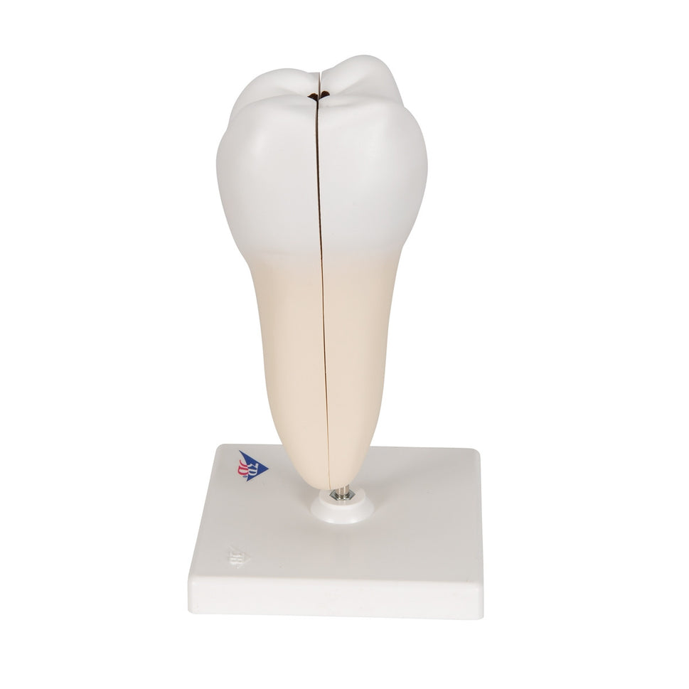Lower Twin-Root Molar Model showing Cavities (2 part)