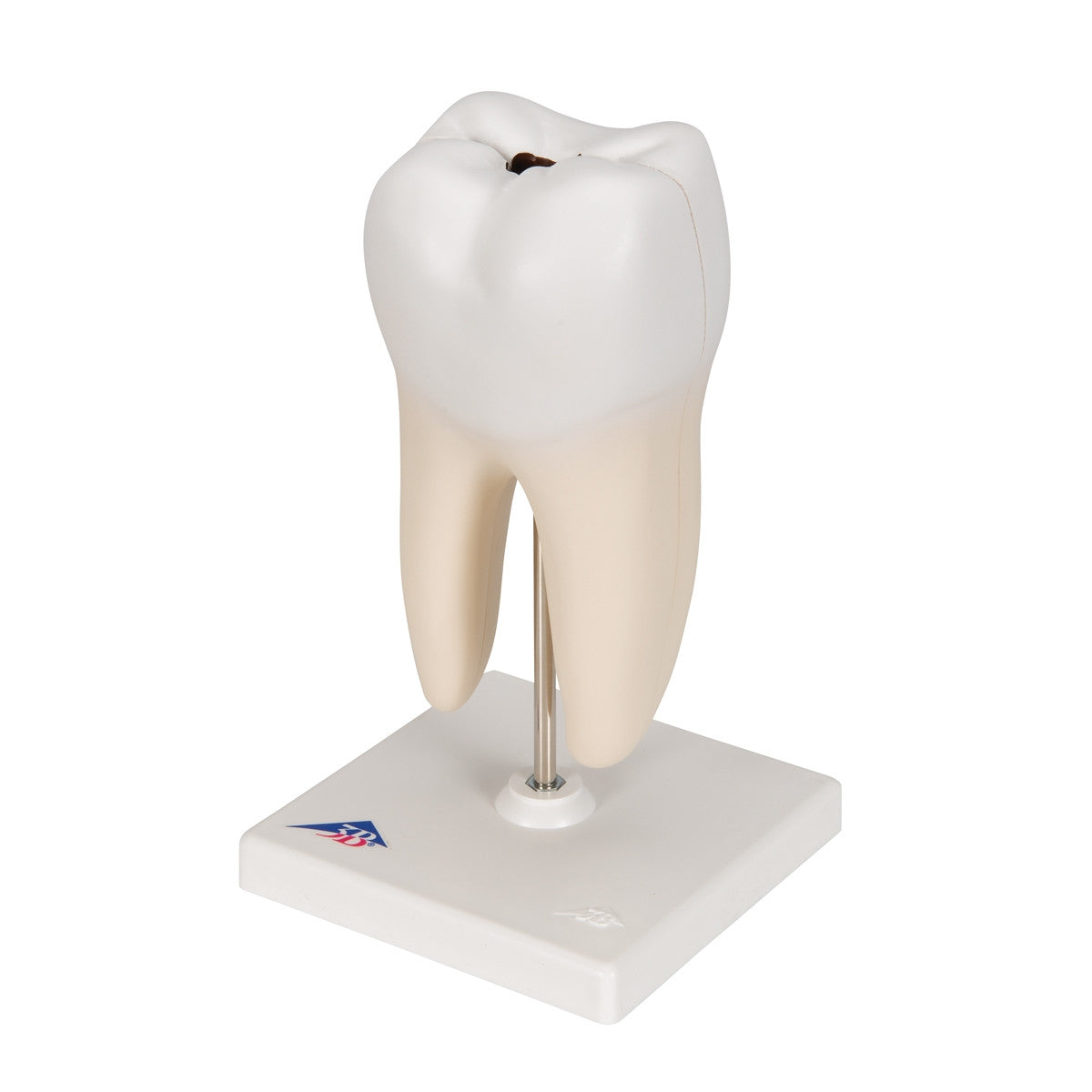 Lower Twin-Root Molar Model showing Cavities (2 part)
