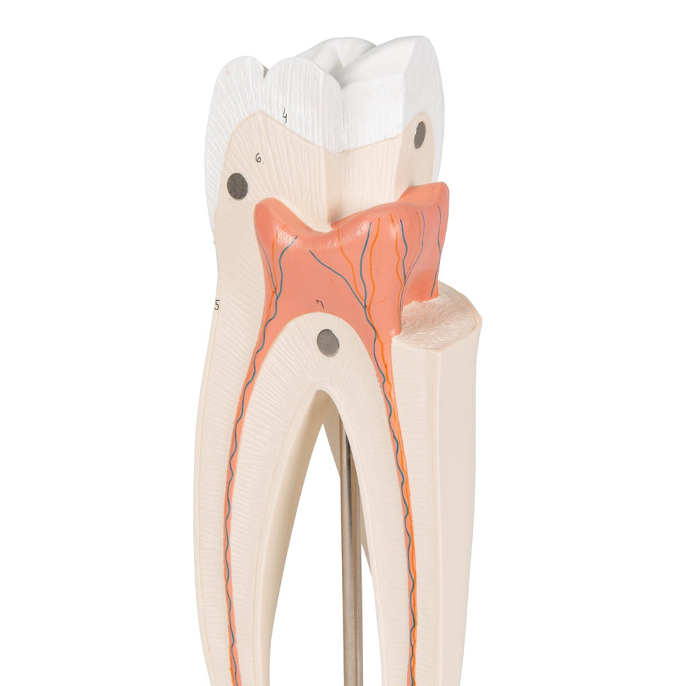 Upper Triple-Root Molar Tooth Model (3 part)
