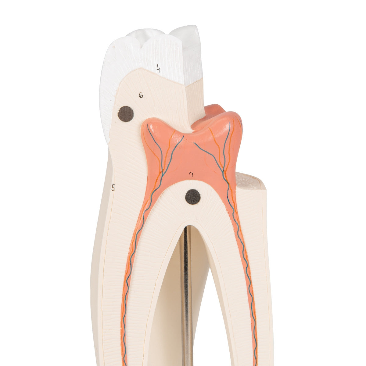 Upper Triple-Root Molar Tooth Model (3 part)
