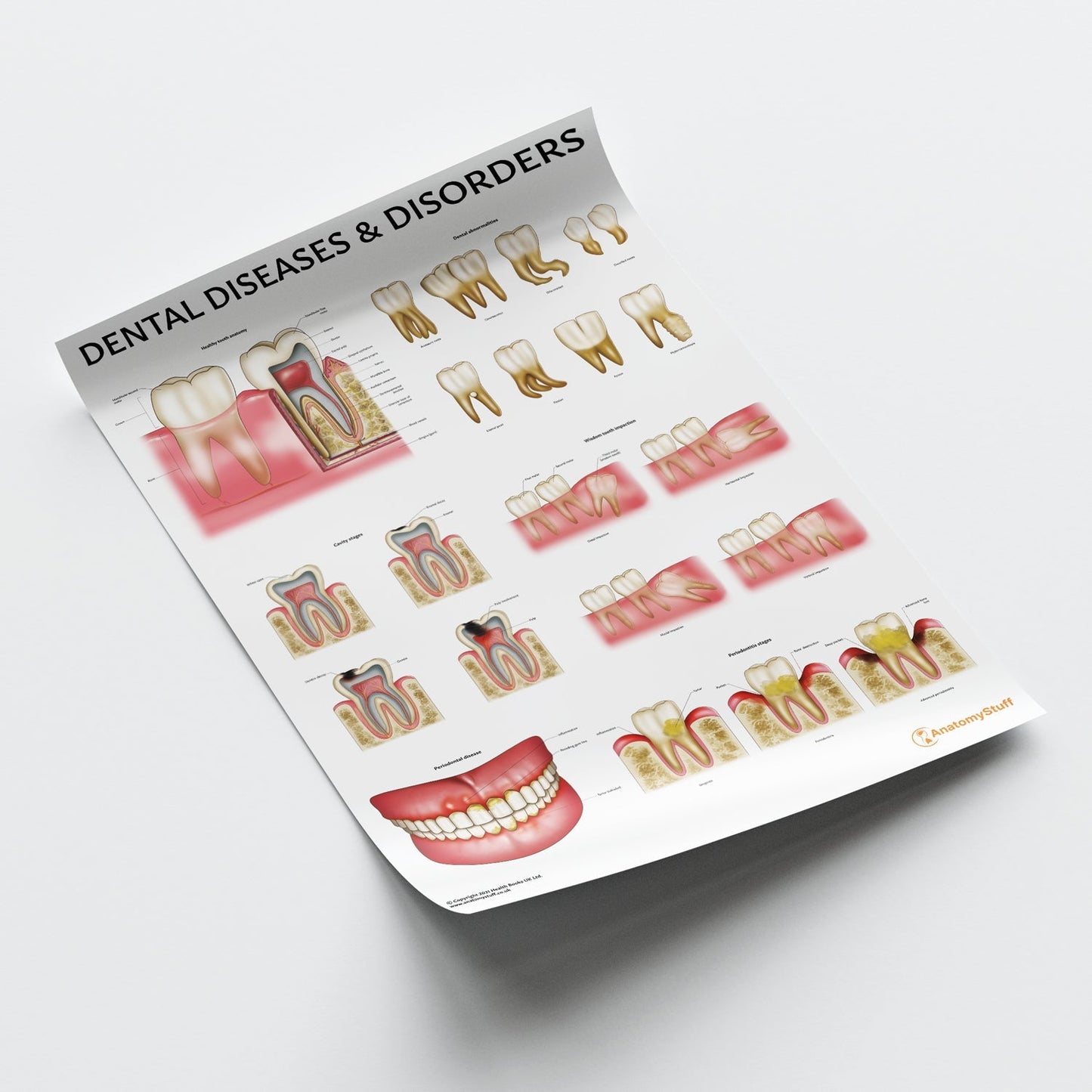 Dental Diseases & Disorders Chart / Poster - Part of Collection