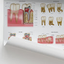 Switch Dental Diseases &amp; Disorders Chart / Poster 2 image