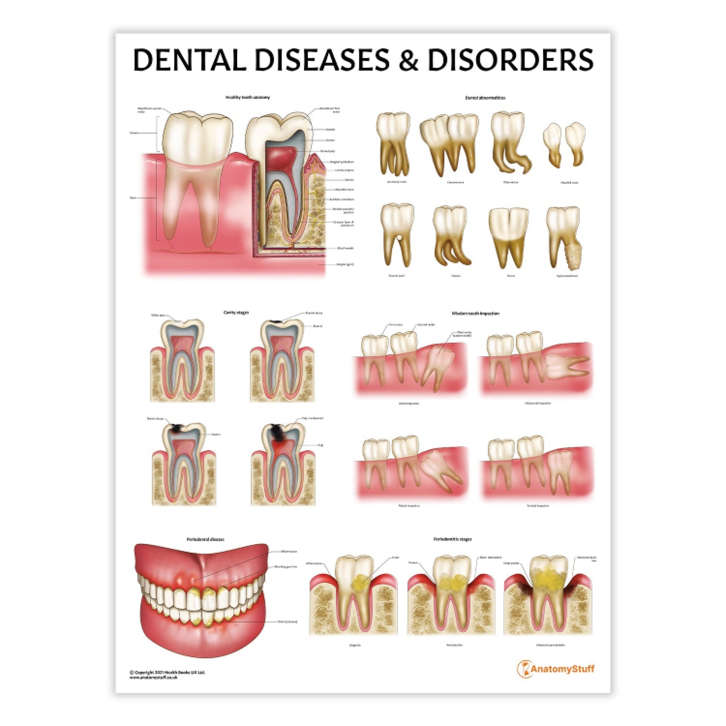 Dental Diseases & Disorders Chart / Poster - Part of Collection
