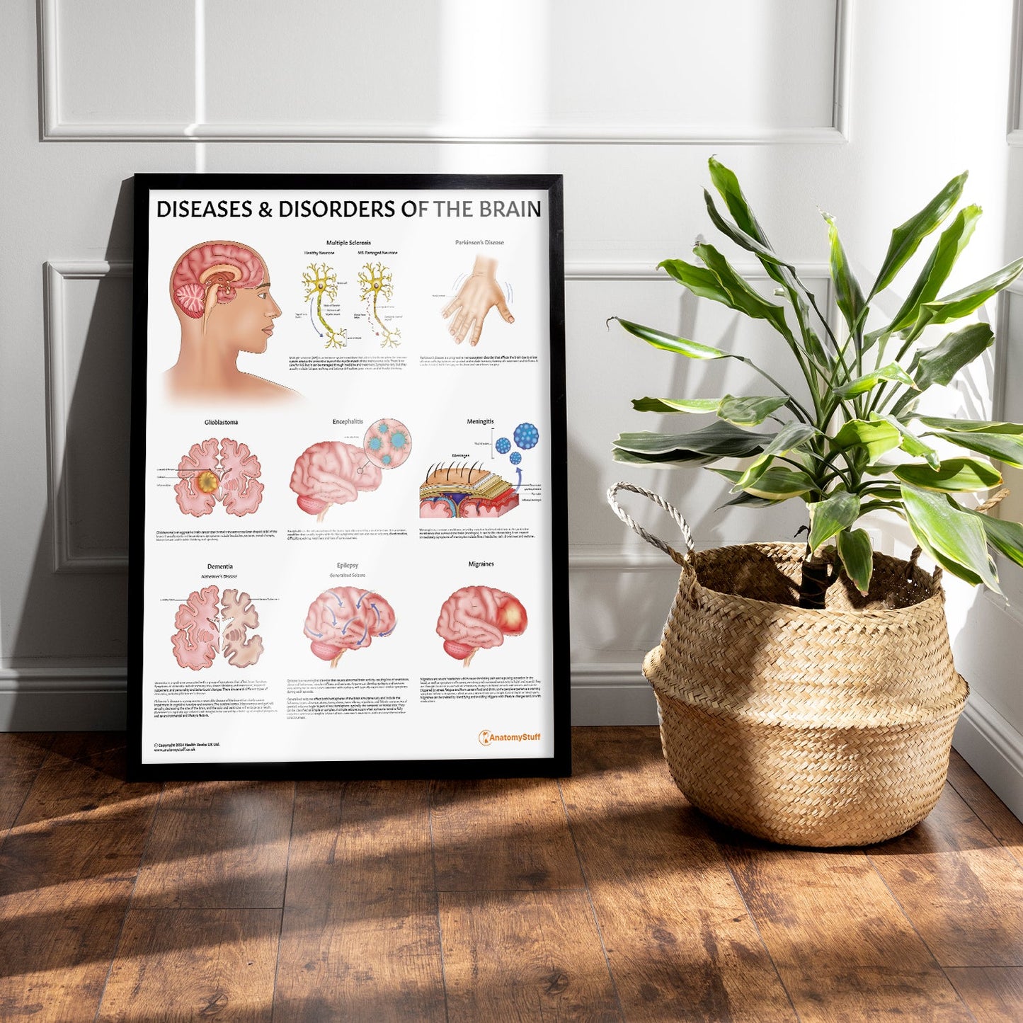 Diseases & Disorders of the Brain Chart / Poster - Part of Collection