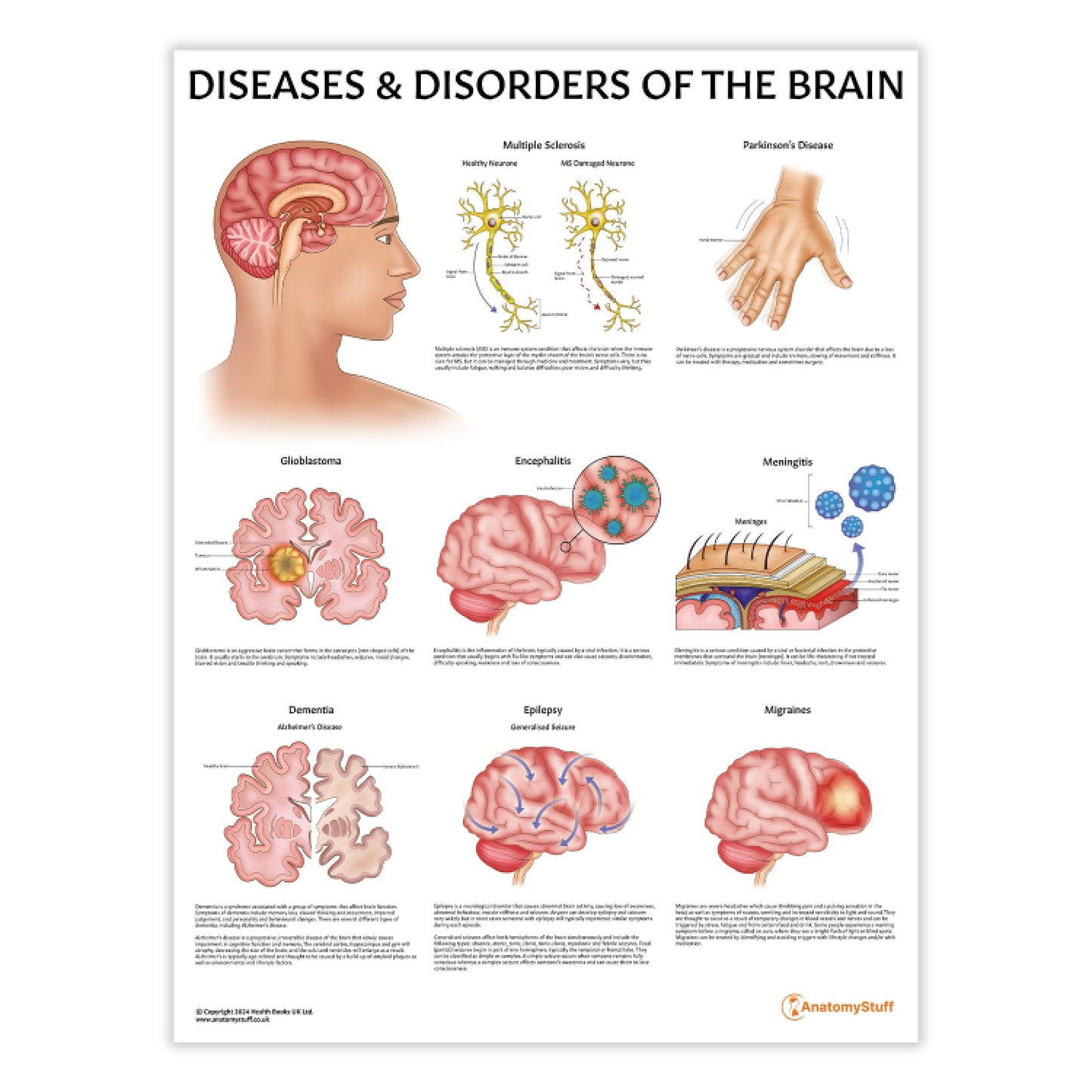 Diseases & Disorders of the Brain Chart / Poster - Part of Collection