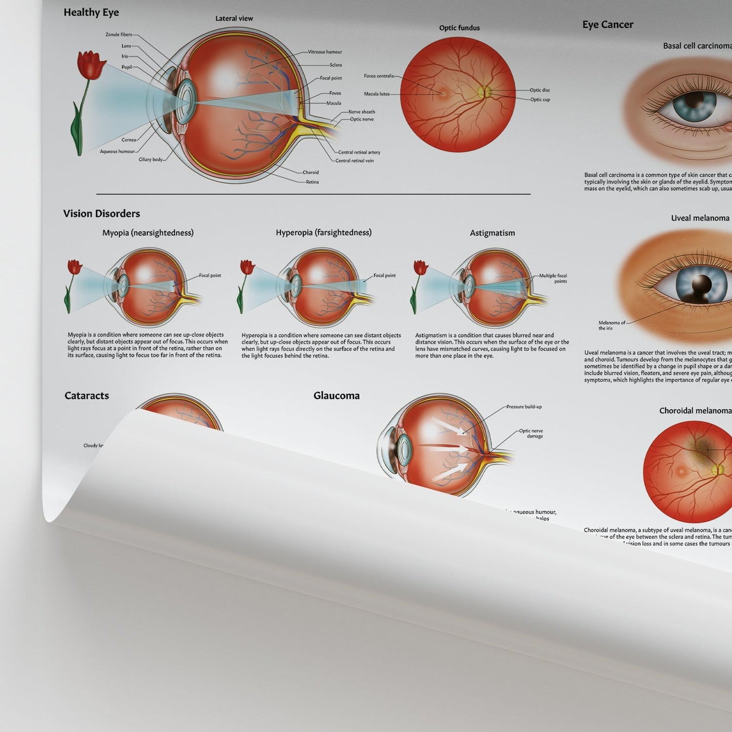 Diseases and Disorders of the Eye Chart / Poster - Part of Collection