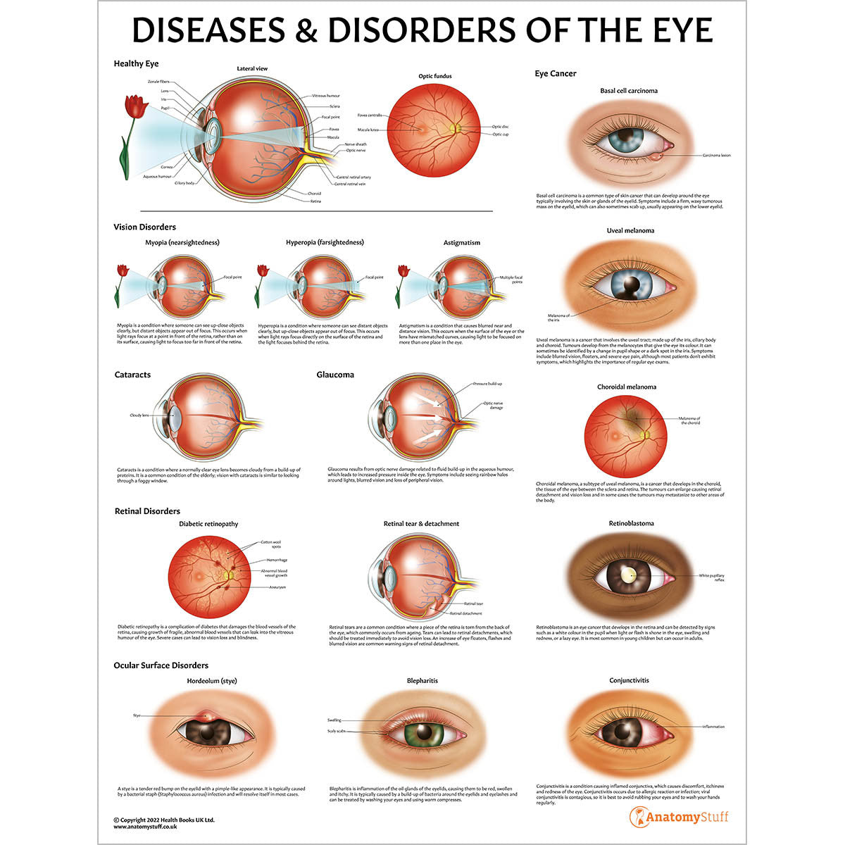 Organ Pathology Posters Collection | Diseases & Disorders – AnatomyStuff