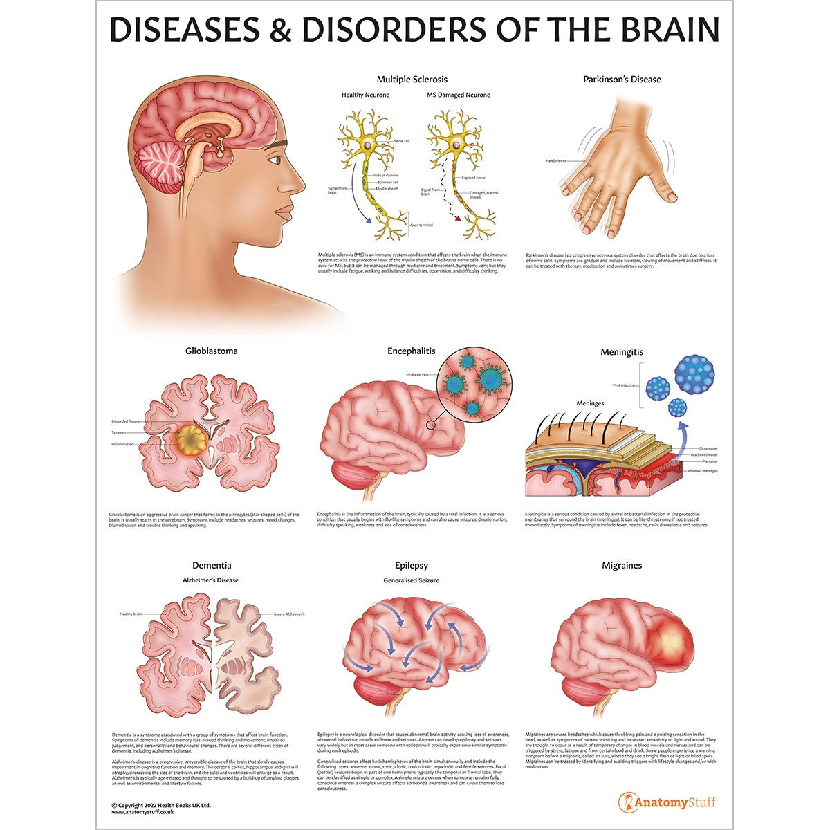 Organ Pathology Posters Collection | Diseases & Disorders – AnatomyStuff