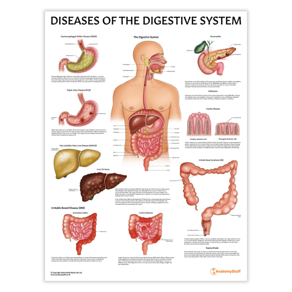 Digestive System Diseases Poster Digestive Anatomy Chart AnatomyStuff