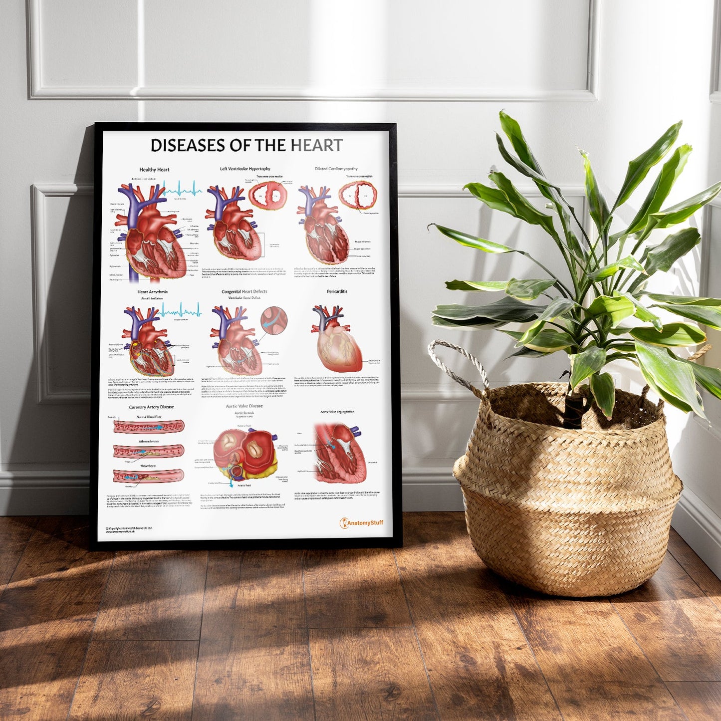Diseases of the Heart Chart / Poster - Part of Collection