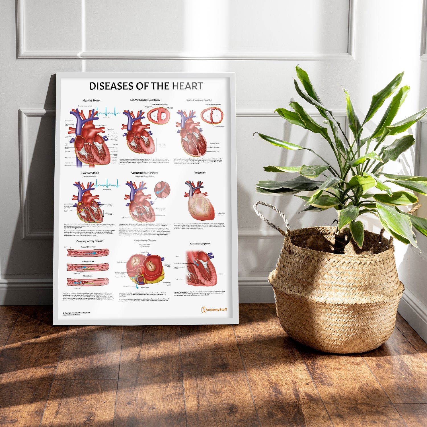 Diseases of the Heart Chart / Poster - Part of Collection