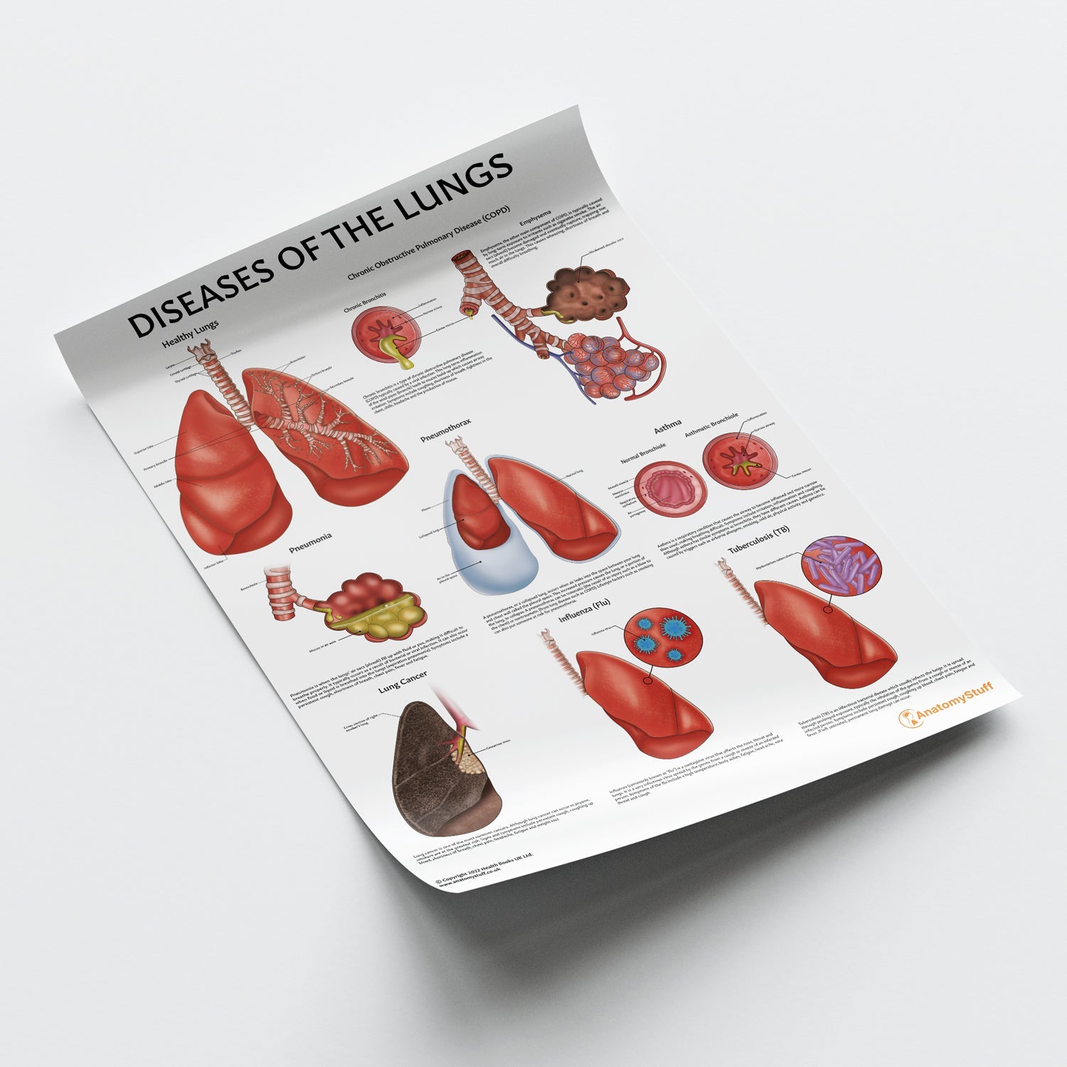 Diseases of the Lungs Chart / Poster - Part of Collection