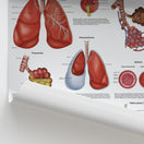 Switch Diseases of the Lungs Chart / Poster 2 image