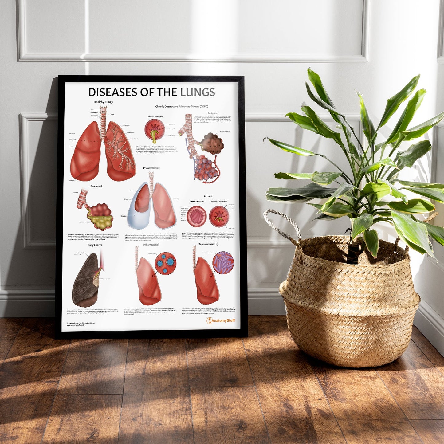 Diseases of the Lungs Chart / Poster - Part of Collection