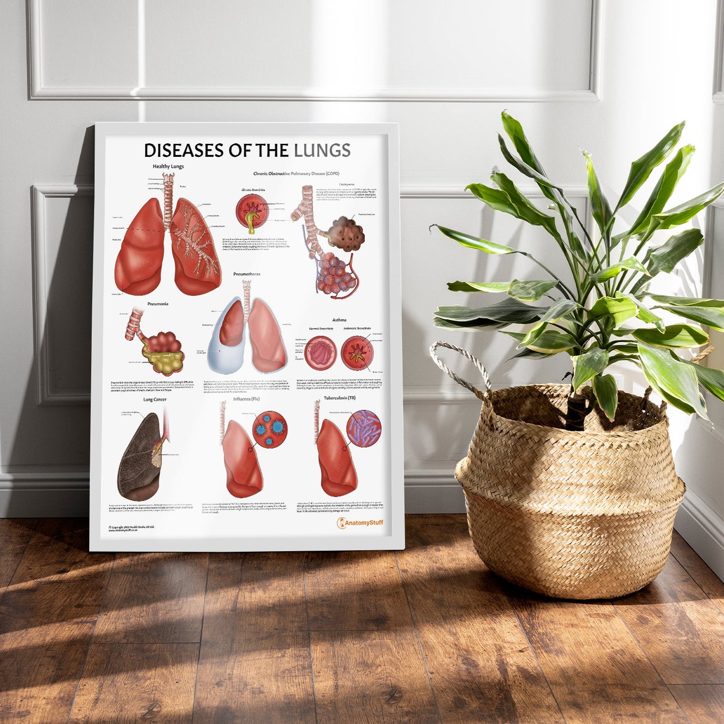 Diseases of the Lungs Chart / Poster - Part of Collection