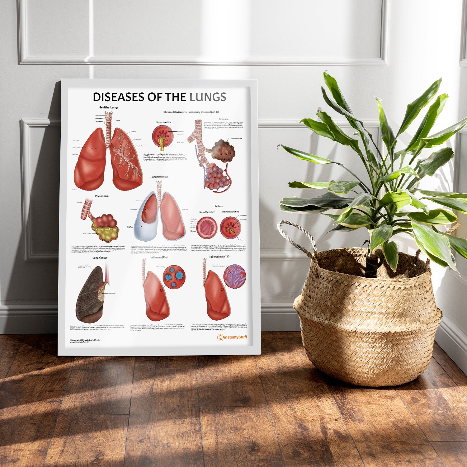 Diseases of the Lungs Chart / Poster - Part of Collection