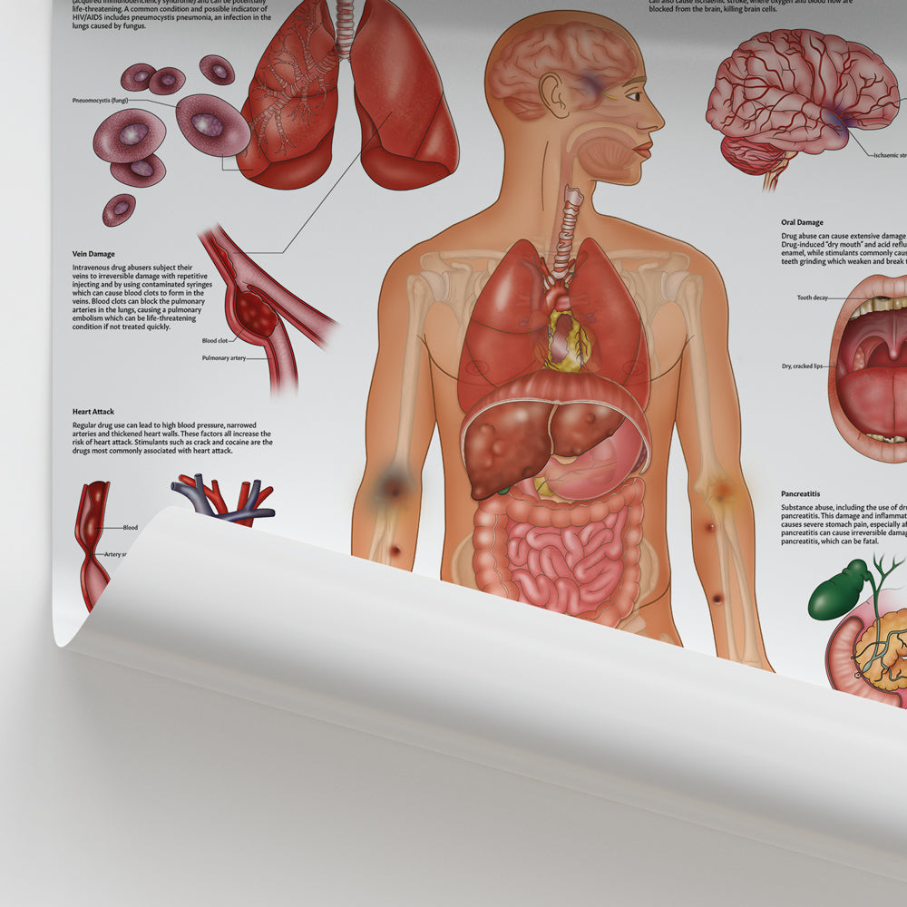 Drugs and The Body Chart / Poster