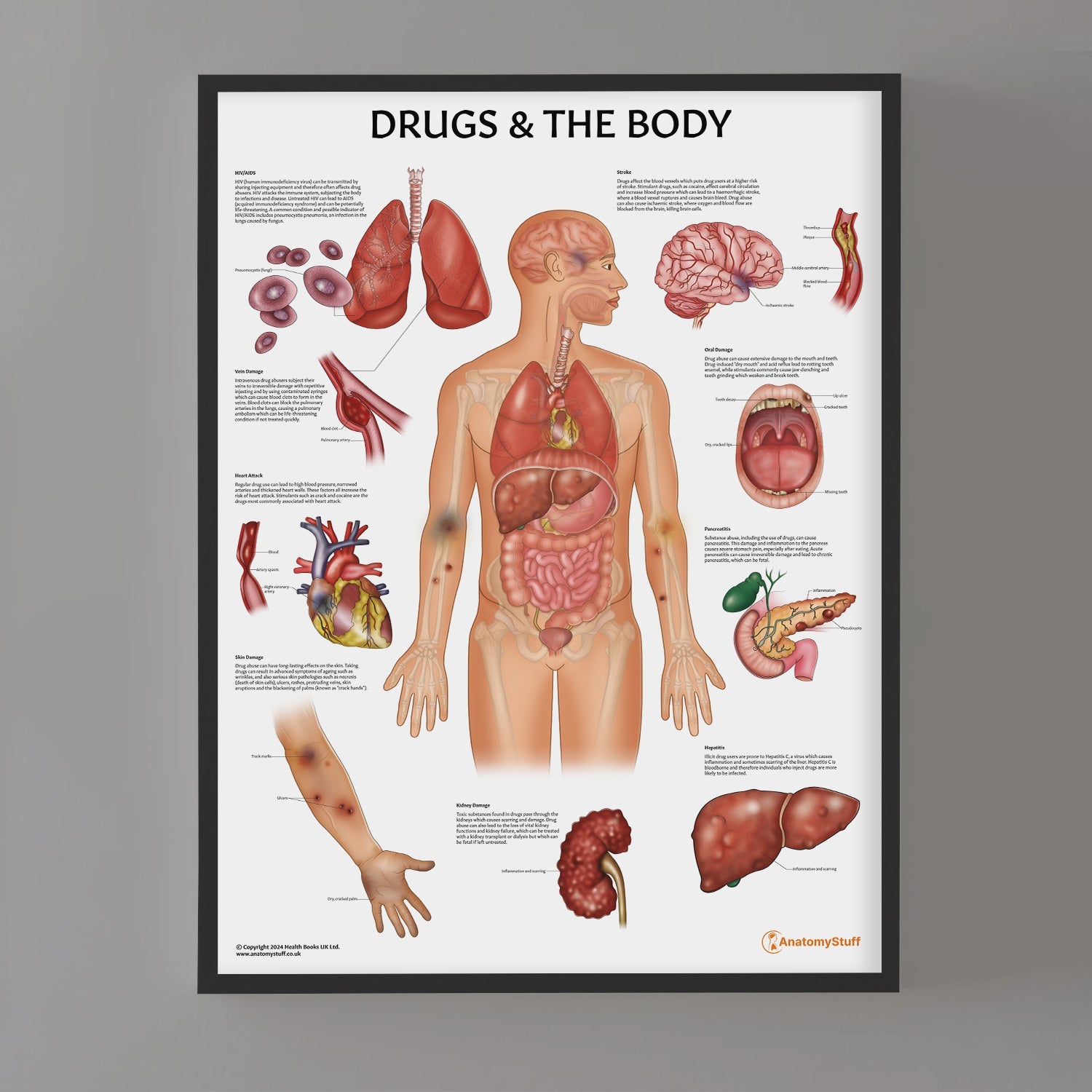 Drugs and The Body Chart / Poster