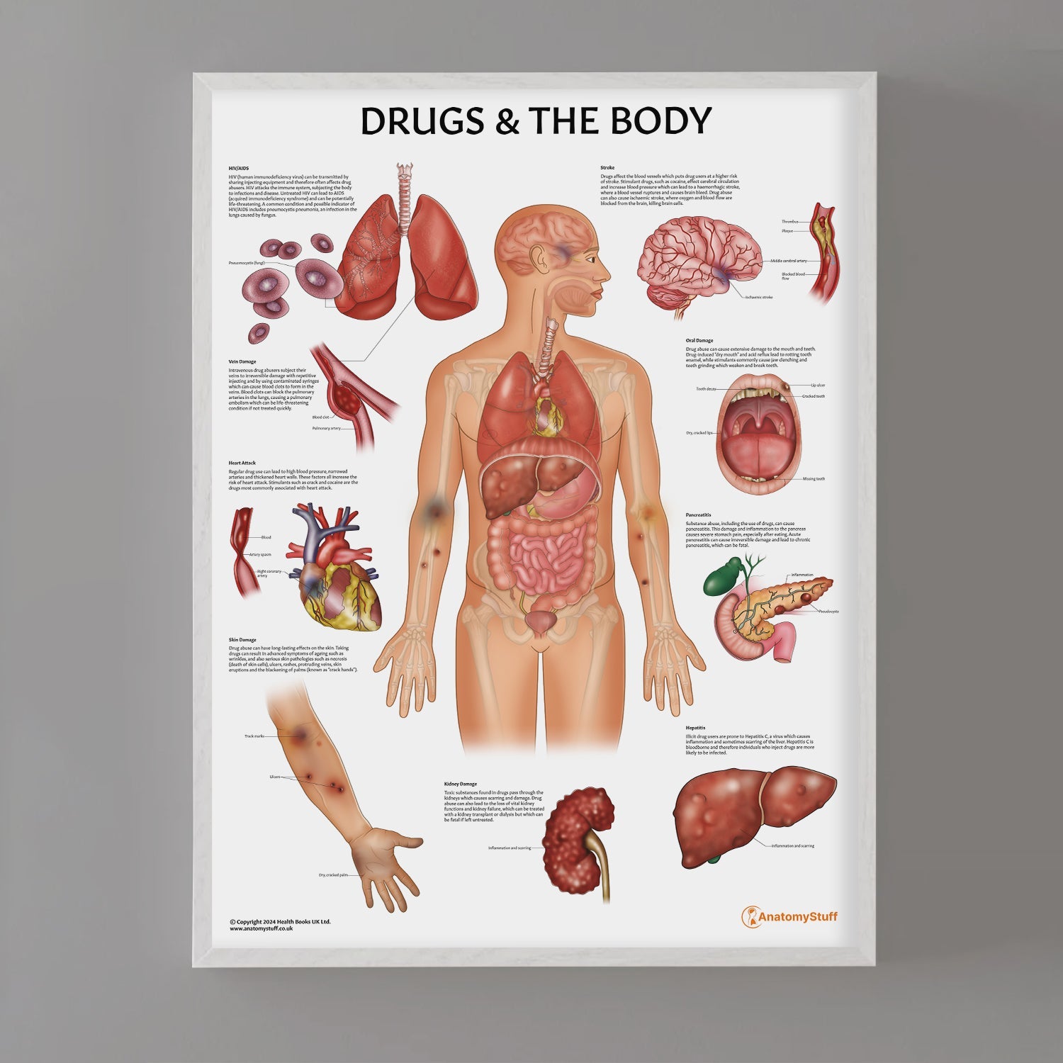Drugs and The Body Chart / Poster