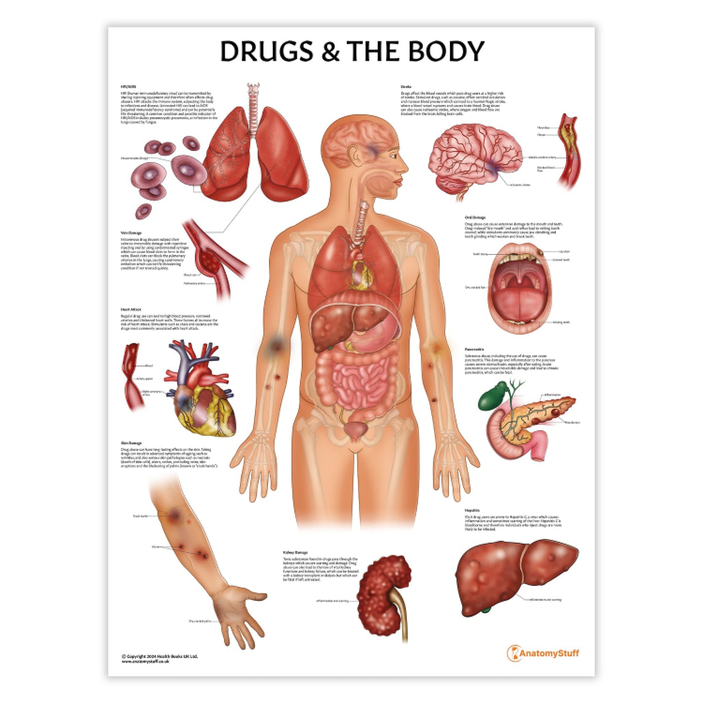 Drugs and The Body Chart / Poster