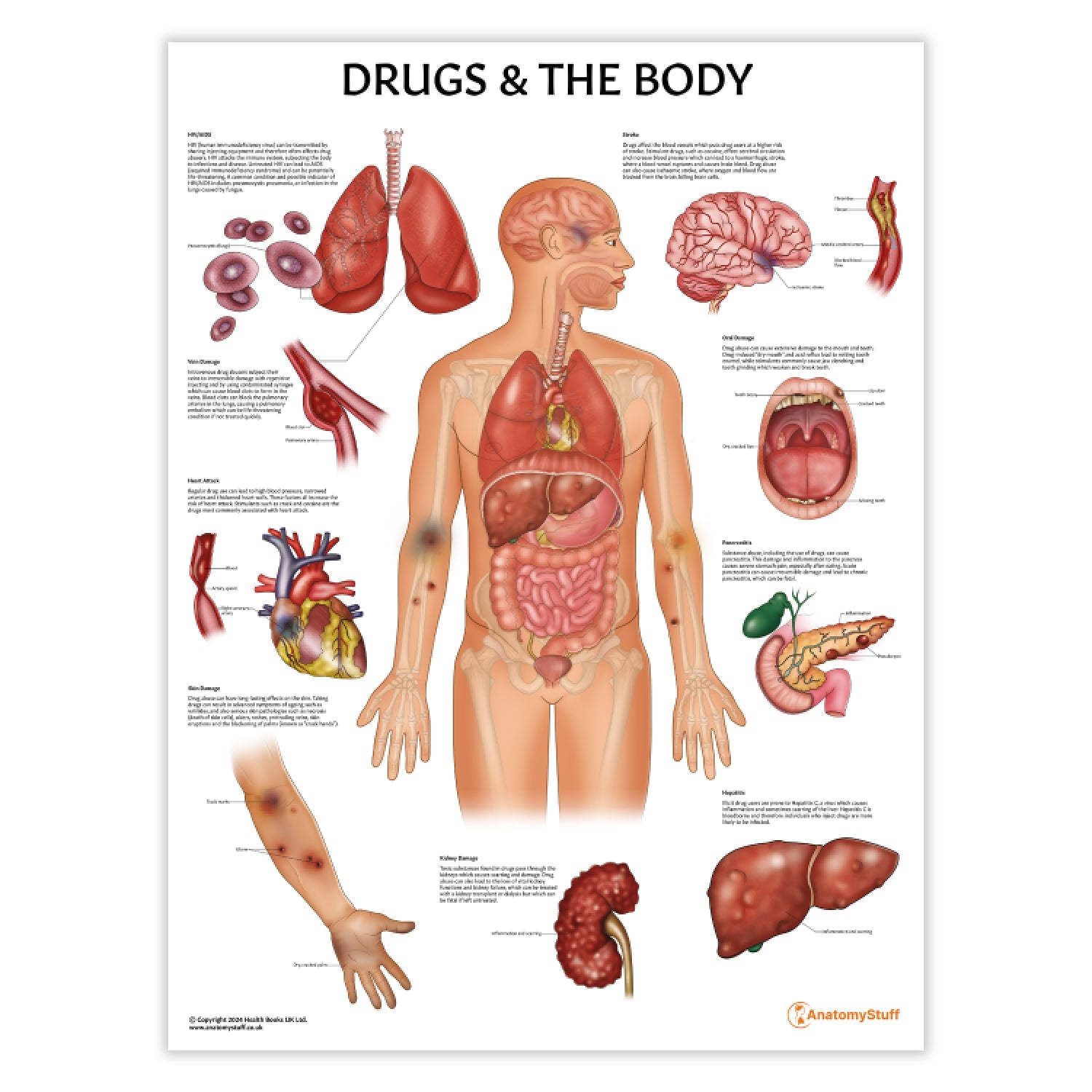 Drugs and The Body Chart / Poster - Part of Collection