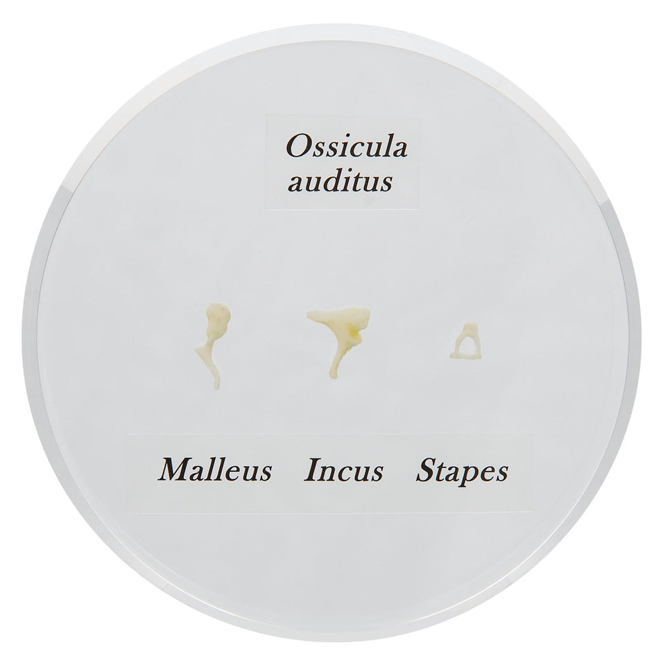 Life-size Auditory Ossicles Model