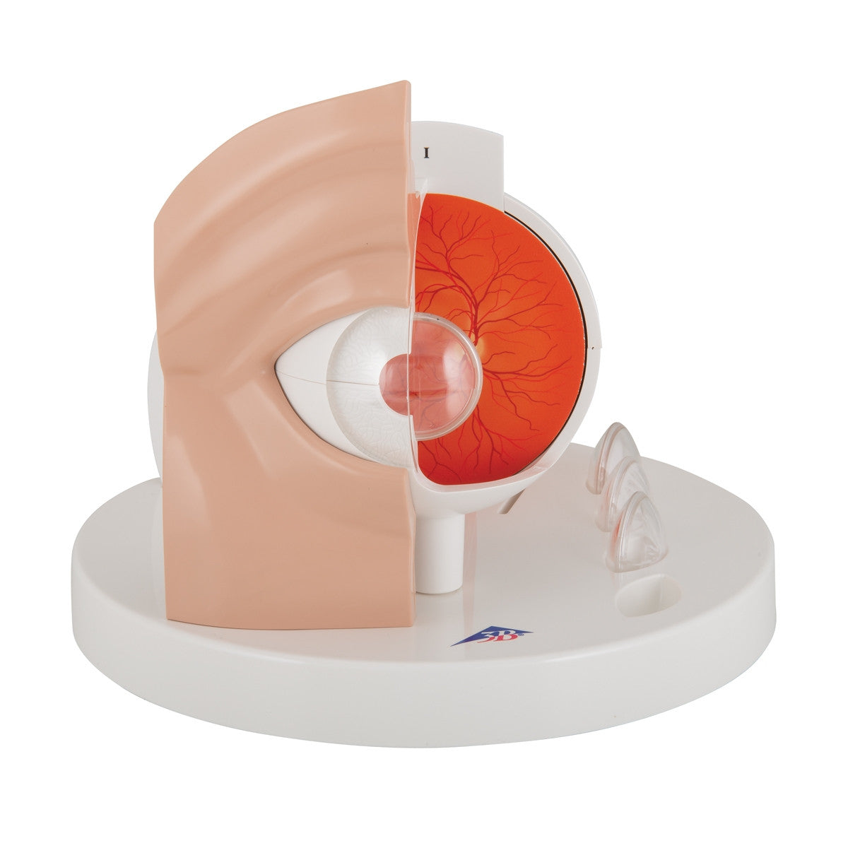 Pathological Eye Model