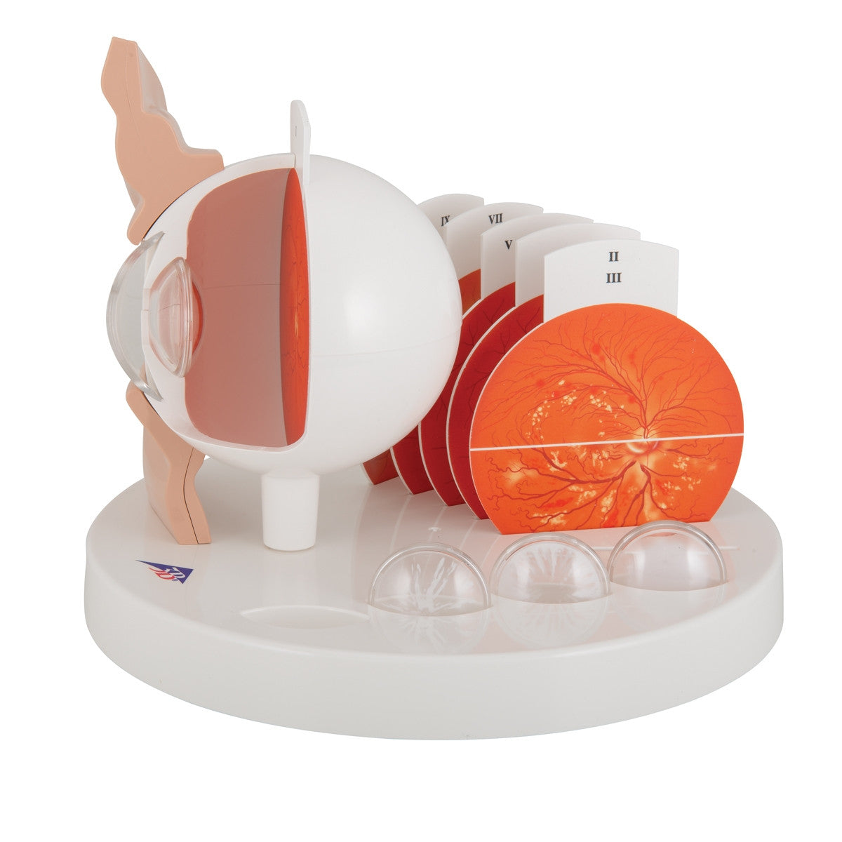 Pathological Eye Model