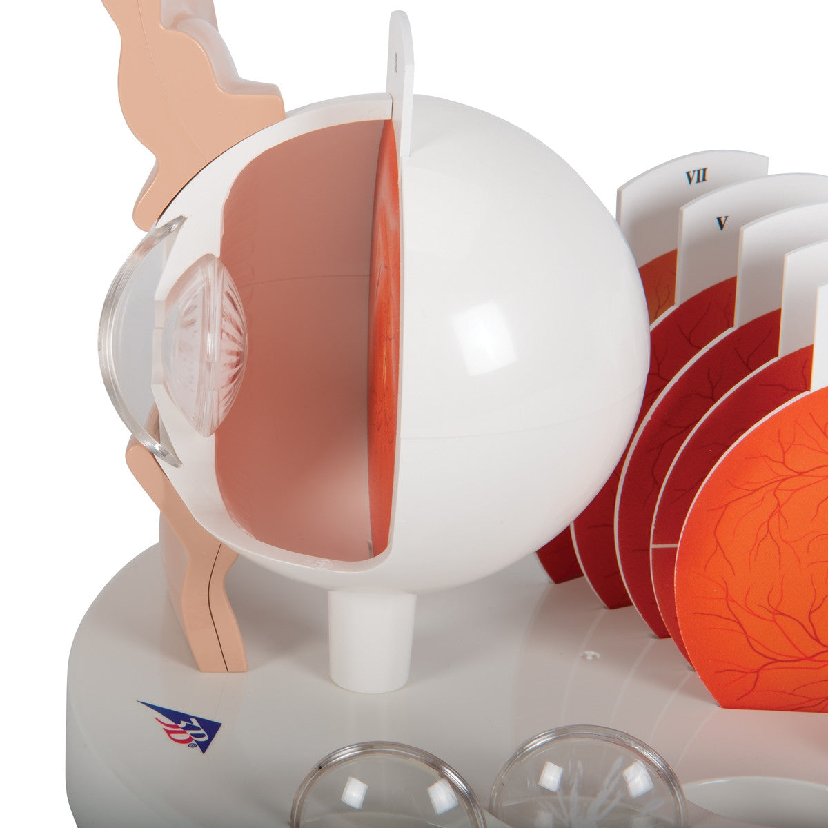 Pathological Eye Model