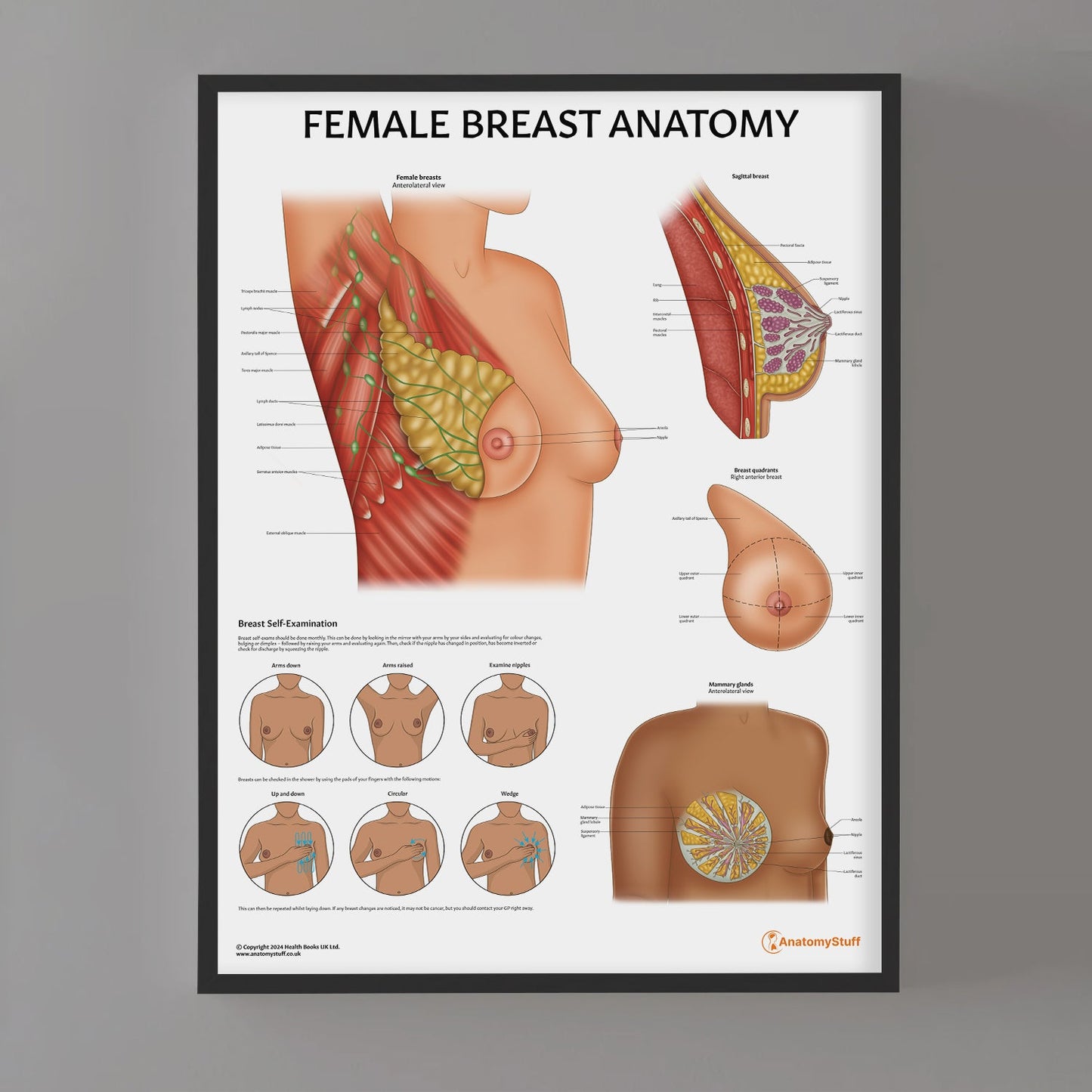 Female Breast Anatomy Chart / Poster - Part of Collection