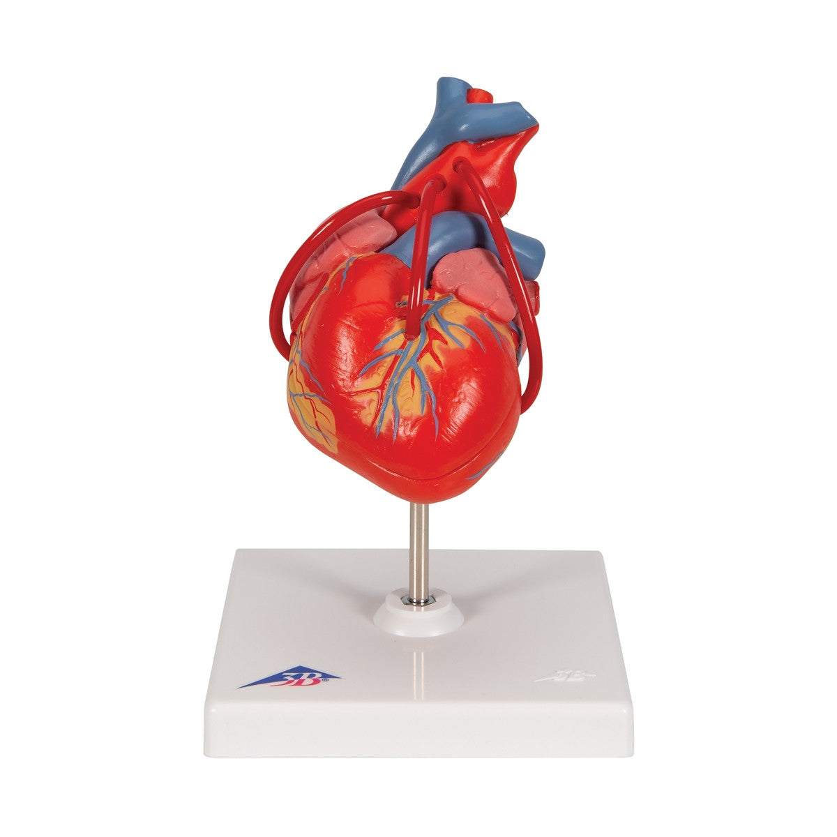 Heart Bypass Model (2 part)