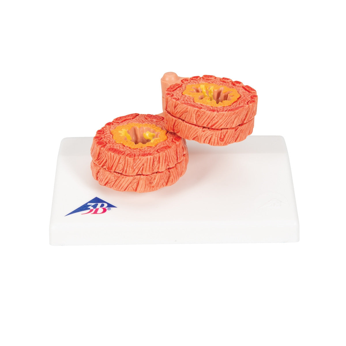 COPD Model 1012788