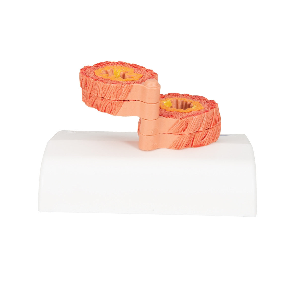 COPD Model