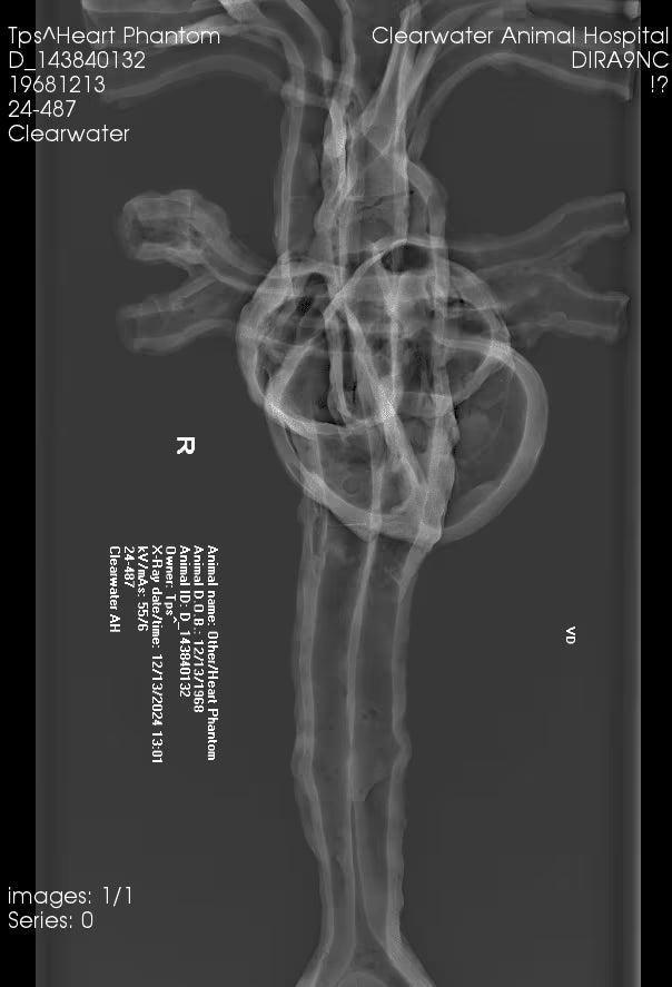 Adult Heart Phantom for X-Ray CT, US, MRI