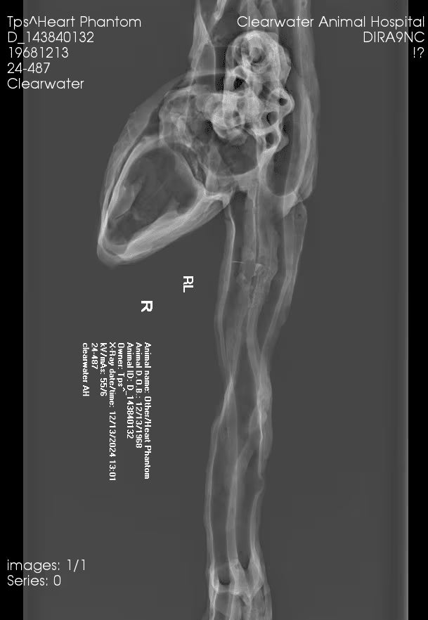 Adult Heart Phantom for X-Ray CT, US, MRI