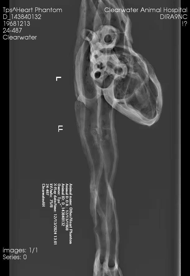 Adult Heart for X-Ray CT, US, MRI HT-A01 / HT-A02 image 20