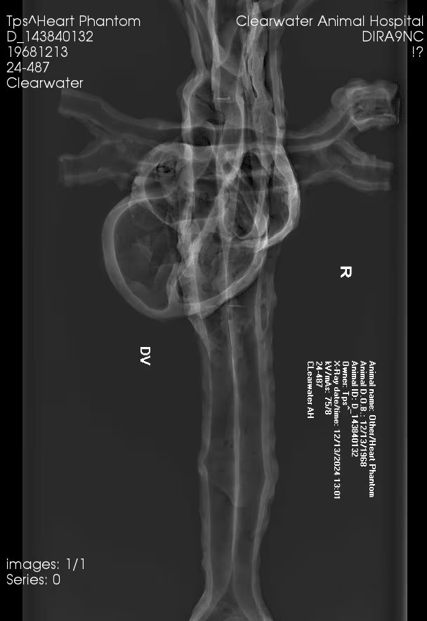 Adult Heart Phantom for X-Ray CT, US, MRI