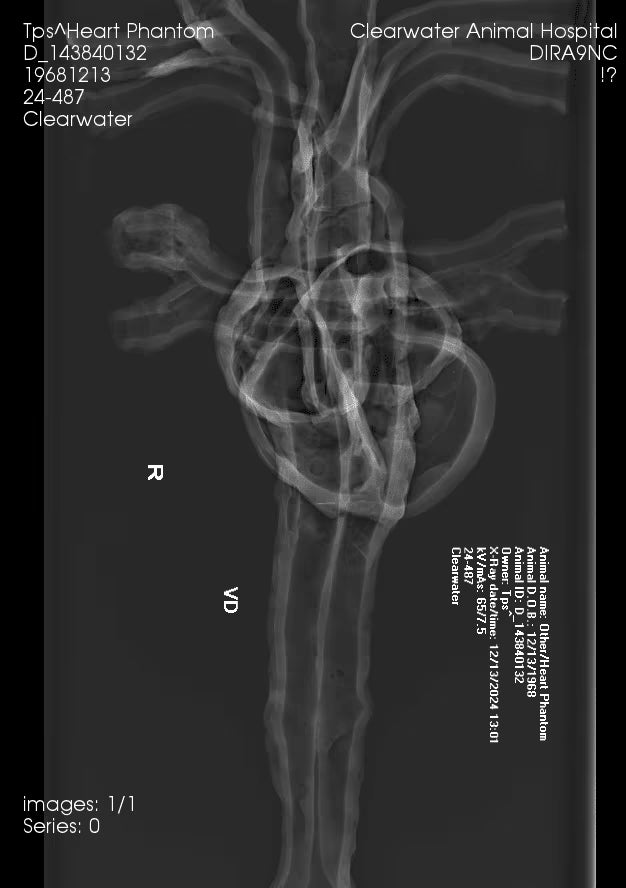 Adult Heart for X-Ray CT, US, MRI HT-A01 / HT-A02 image 16