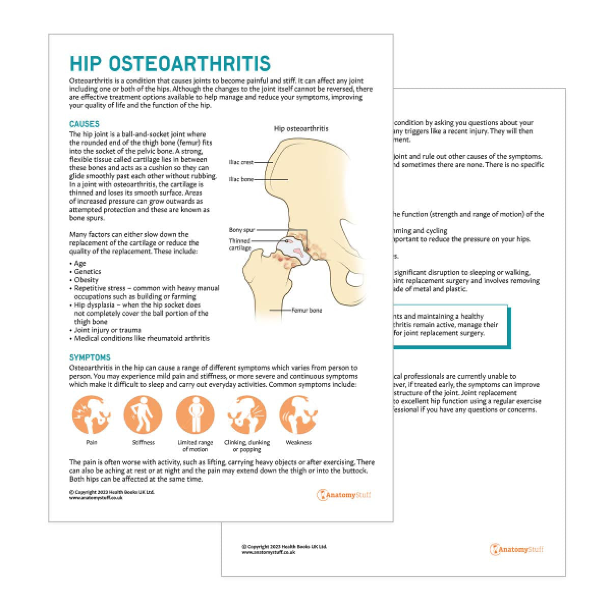Hip Osteoarthritis Patient Education Handout