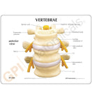 Switch A two-sided patient education card accompanies the model to help with identification of key parts 3 image