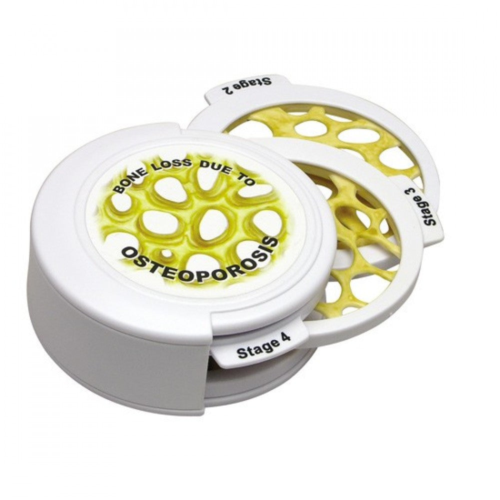 Osteoporosis Education Collection