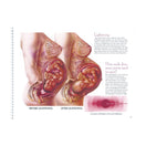 Switch Lightening process of childbearing charts for antenatal or midwifery education 3 image