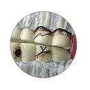 Switch The model demonstrates the effects that TMJ dysfunction has on teeth 2 image